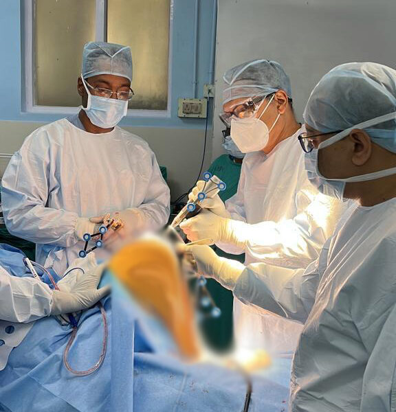 Dr. Biren Nadkarni Performing Knee Replacement Surgery 4